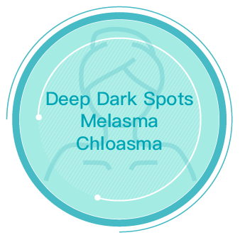 Deep Dark Spots