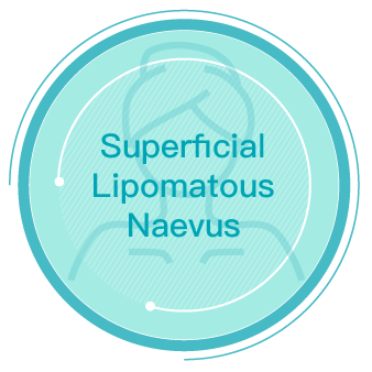 Superficial Lipomatous Naevus